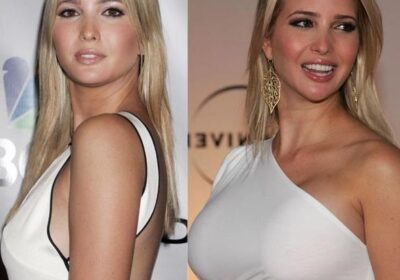 ivanka trump augmentation mammaire