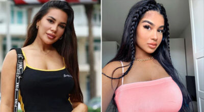 Feliccia, a-t-elle fait une chirurgie pour ressembler à Milla Jasmine