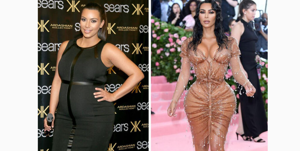 kim-kardashian-mommy-makeover