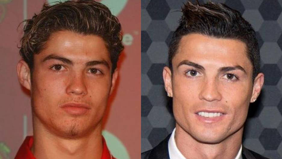 cristiano-ronaldo-chirurgie5