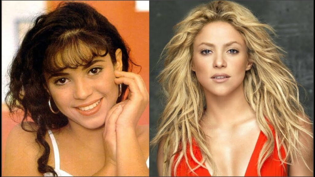 shakira-chirurgie-esthetique