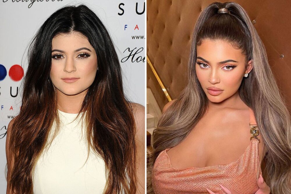 kylie-jenner-avant-apres