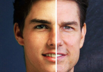 tom-cruise-visage-avant-apres