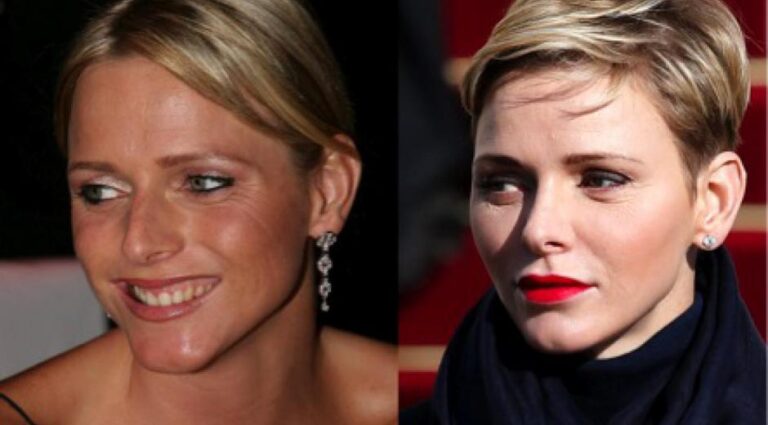 Charlene De Monaco Visage