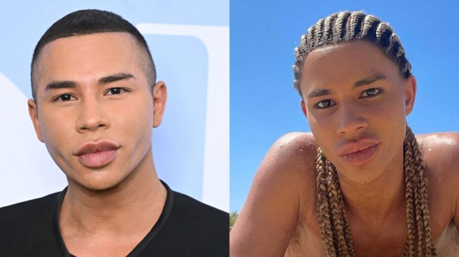 olivier rousteing plastic surgery Image 3